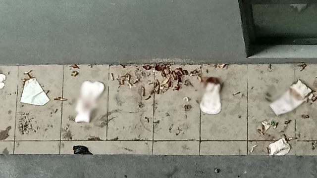 “Disgusting!” Used Menstrual Pads Are Being Thrown Out The Window At This Luxury Condo In KL