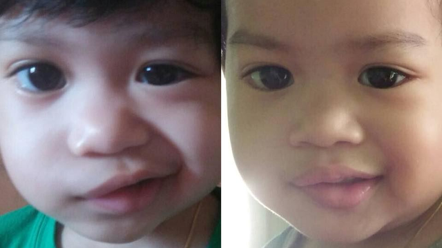 Jangan Suka Korek Telinga Anak, Wanita Ini Kongsi Kisah 