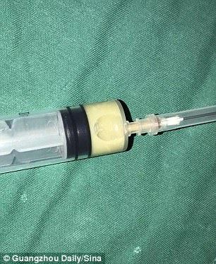 budak 10 tahun ada jangkitan otak lepas ibu picit blackhead