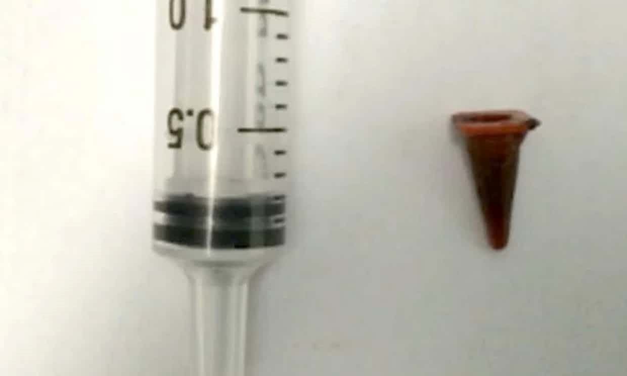 disangka hidap tumor pada paru-paru, rupanya lelaki ini tertelan kon trafik