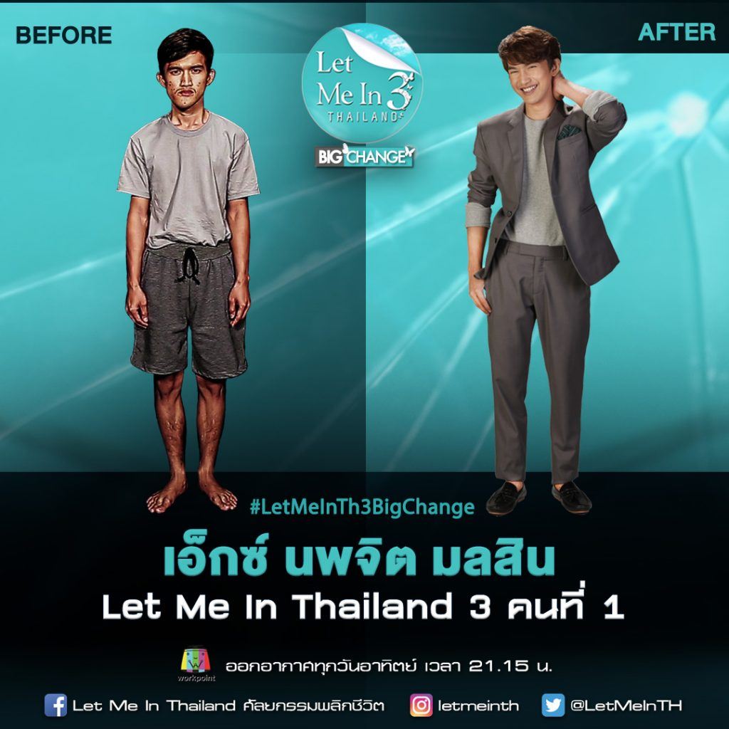 ibu dah tak kenal anak selepas anak buat pembedahan plastik 