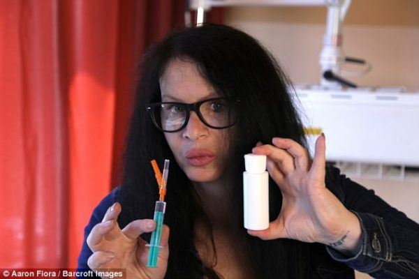 takutnya ! wanita ni sanggup suntik bakteria 3.5 juta tahun nak nampak muda