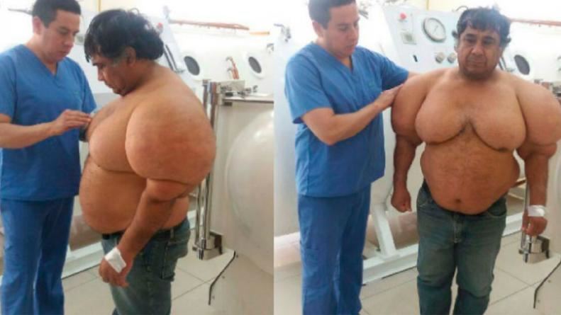 badan lelaki tiba-tiba jadi seperti belon selepas menyelam