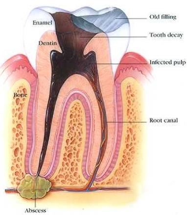 6 tabiat harian yang boleh pendekkan umur. nombor 5 paling ramai buat