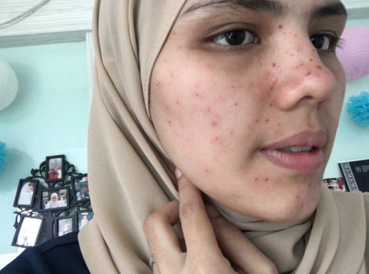 merana nak cantik, wanita ni kongsi kisah from pretyy to ugly