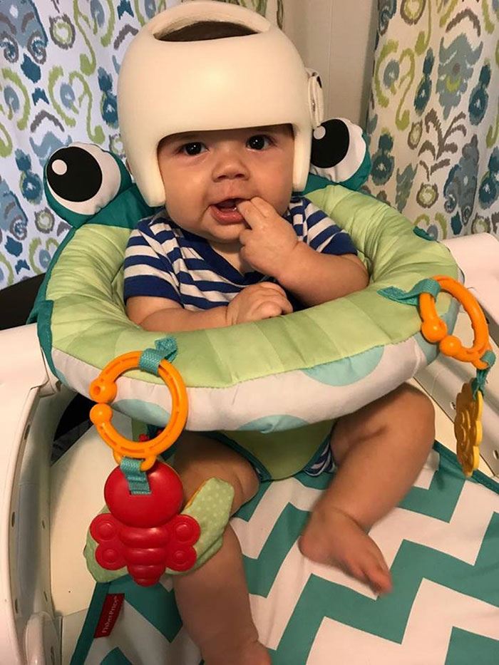 ada sebab kenapa baby ni kena pakai helmet, tapi tengok apa family dia buat