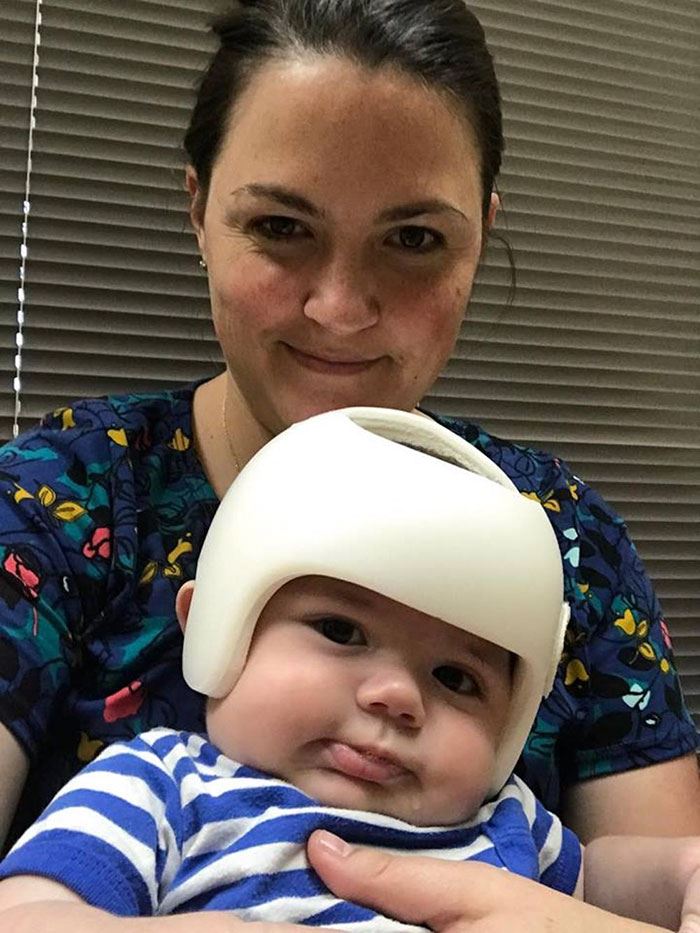 ada sebab kenapa baby ni kena pakai helmet, tapi tengok apa family dia buat