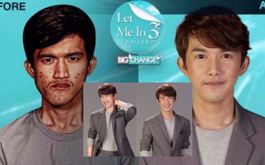 ibu dah tak kenal anak selepas anak buat pembedahan plastik 