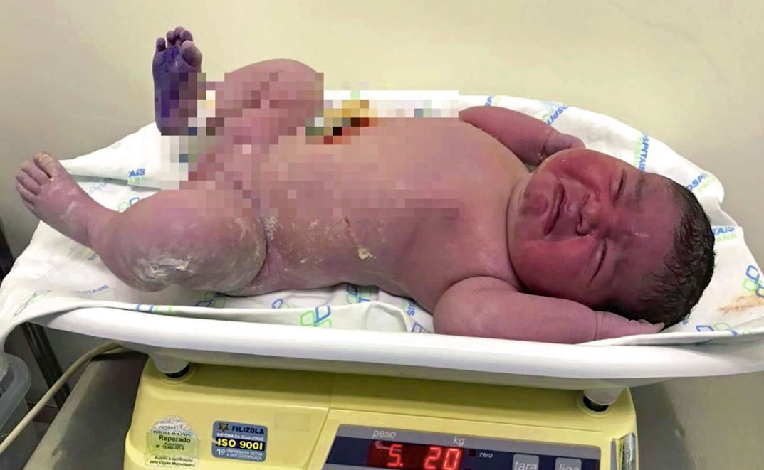 ingatkan mengandung anak kembar, lepas bersalin bayi gergasi pula