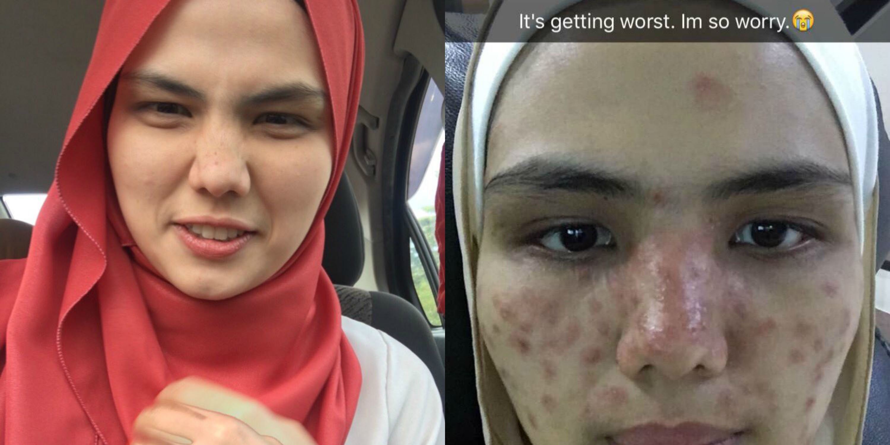 merana nak cantik, wanita ni kongsi kisah from pretyy to ugly