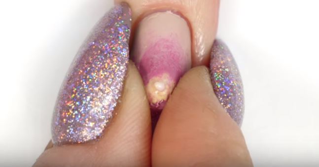 kuku berjerawat ini mungkin jadi trend hujung tahun 2017