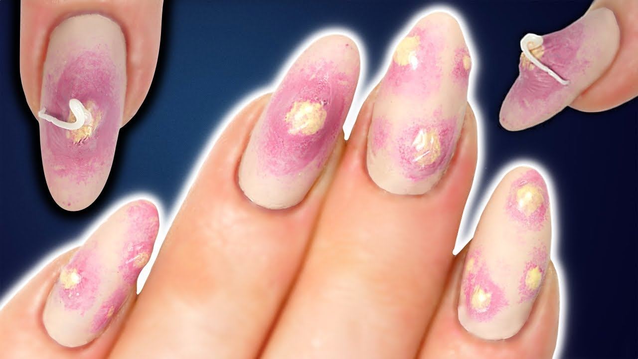 kuku berjerawat ini mungkin jadi trend hujung tahun 2017