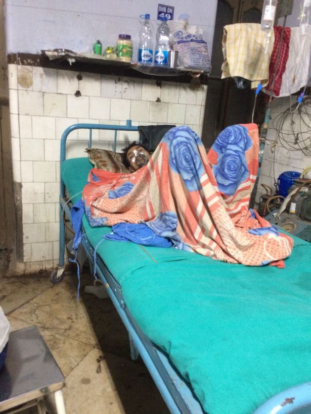 doktor guna magnet buang 600 paku dalam perut lelaki ini