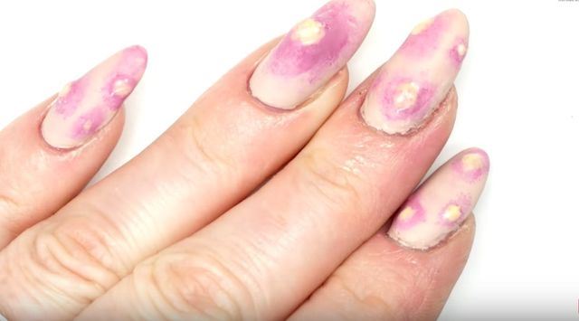 kuku berjerawat ini mungkin jadi trend hujung tahun 2017