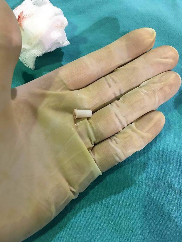 kesian adik ni tertelan trumpet ketika parti, terpaksa bersuara bunyi horn