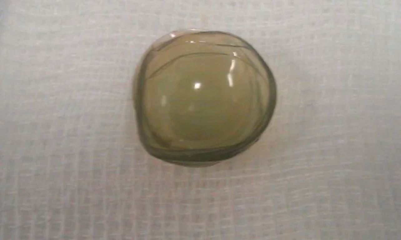 doktor jumpa 27 kanta lekap pada mata wanita ini