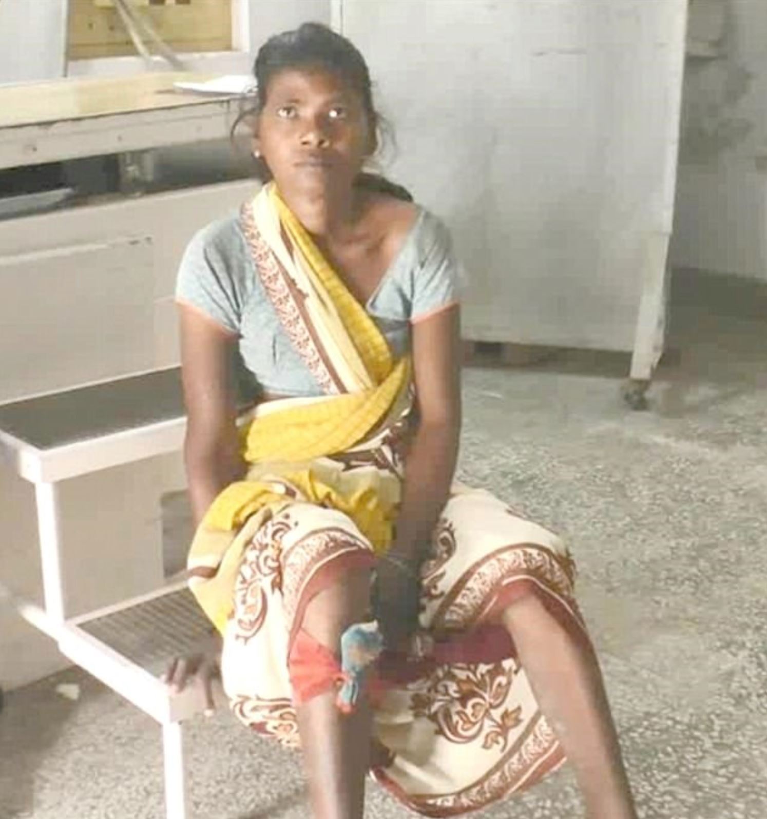 jarum dan pin antara 70 objek tajam yang keluar daripada kaki wanita ini