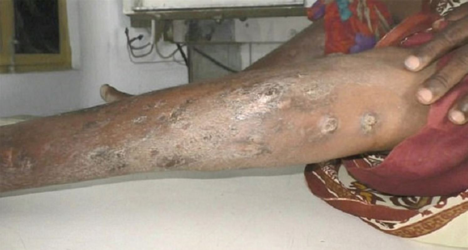 jarum dan pin antara 70 objek tajam yang keluar daripada kaki wanita ini