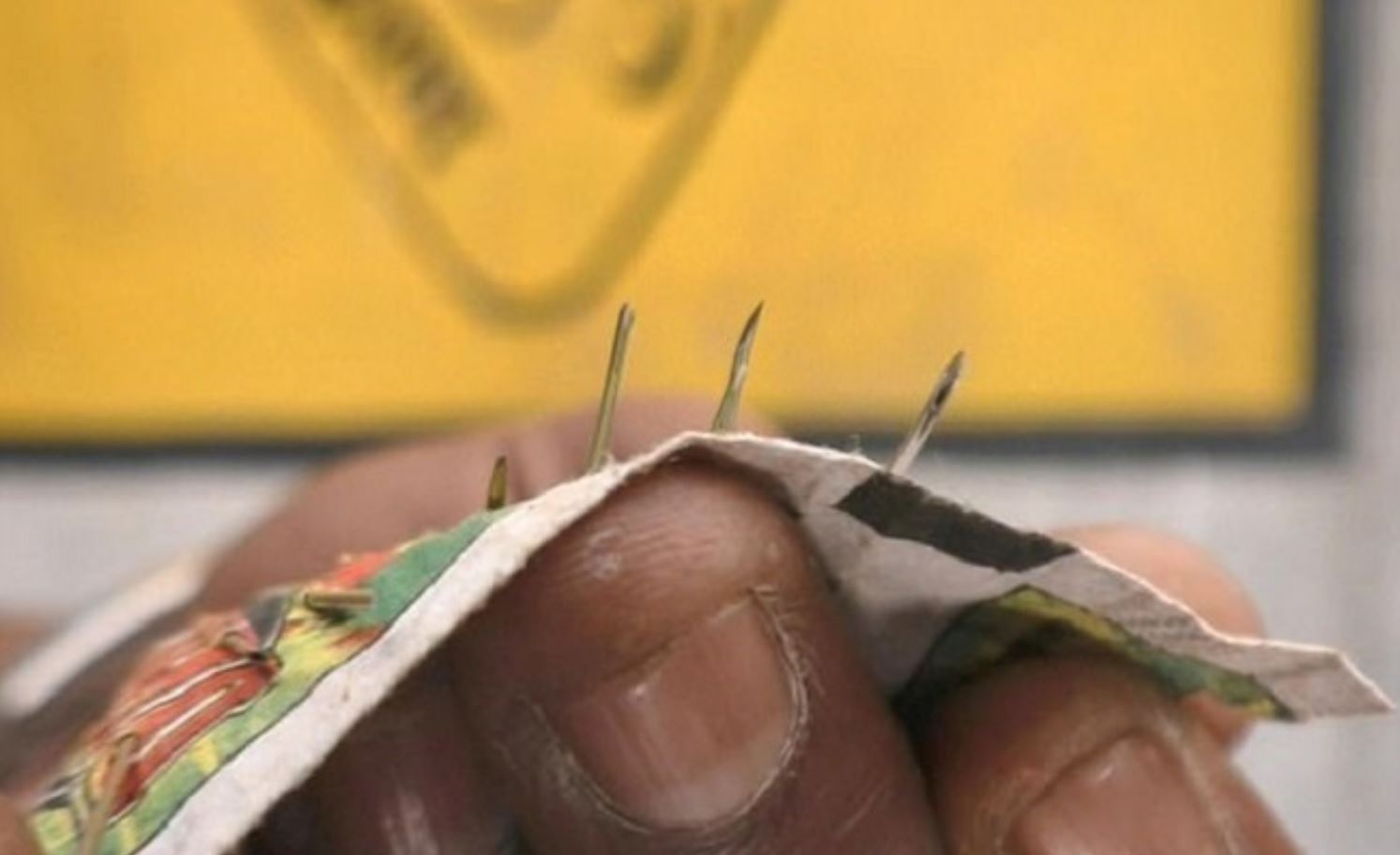 jarum dan pin antara 70 objek tajam yang keluar daripada kaki wanita ini