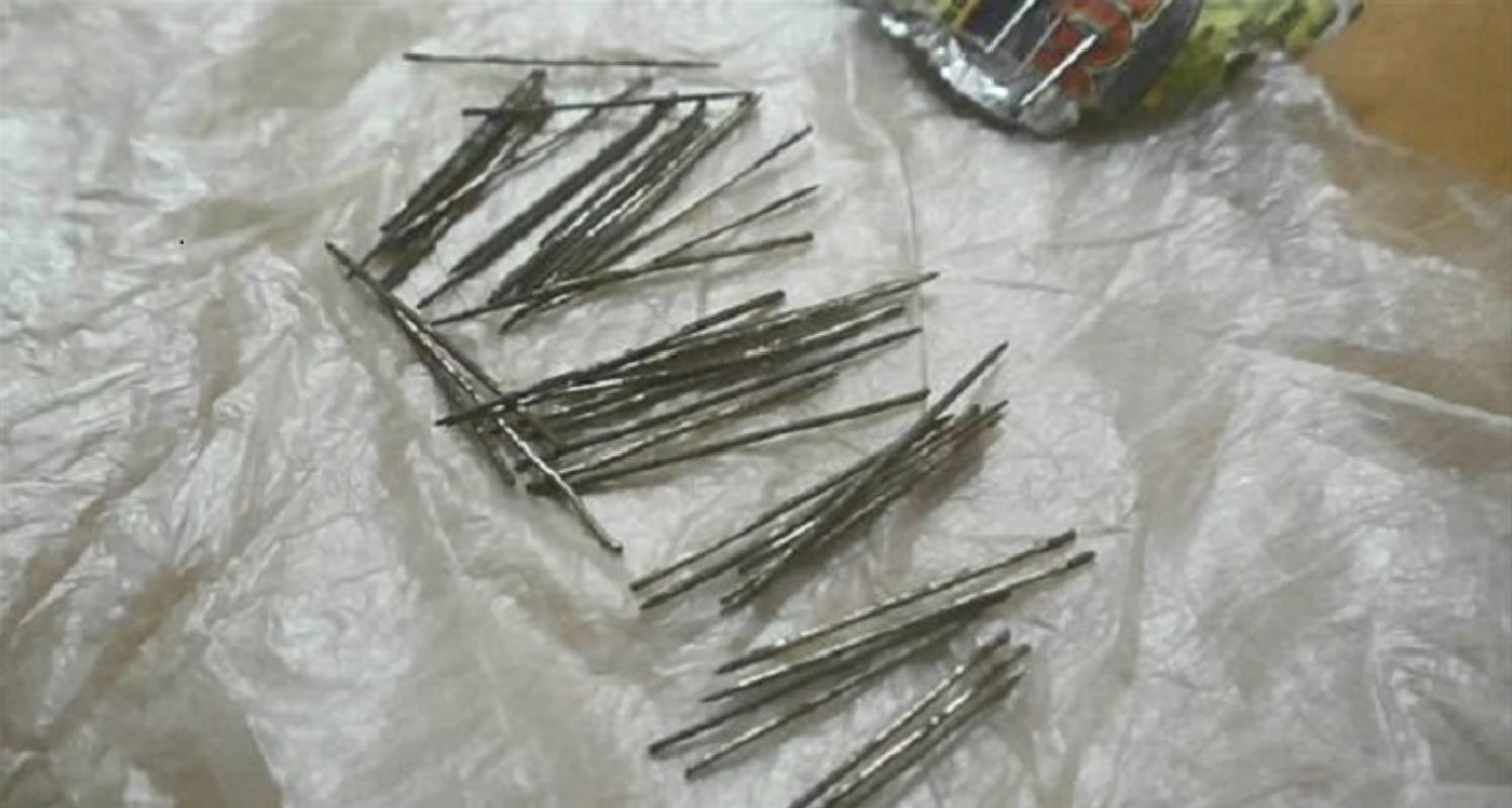 jarum dan pin antara 70 objek tajam yang keluar daripada kaki wanita ini