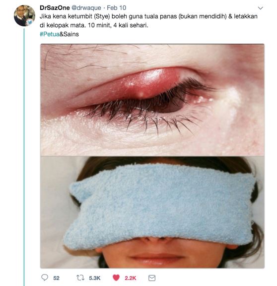 ketumbit bukan sebab mengintai, ni doktor bagi petua hilangkan