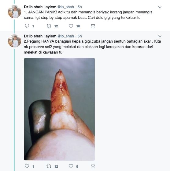 alamak ! gigi kekal patah, apa nak buat ? 