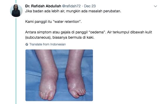 badan berlebih air dengan gemuk air sama ke ? ni jawapannya