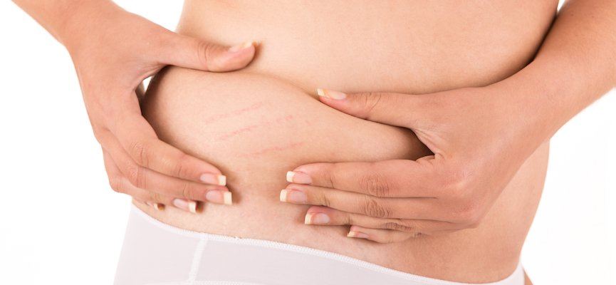 kenapa perempuan lagi senang ada selulit daripada lelaki? 