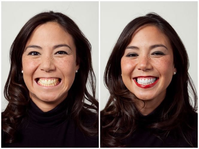 gigi kekuningan lebih sihat dan normal. ini sebabnya.