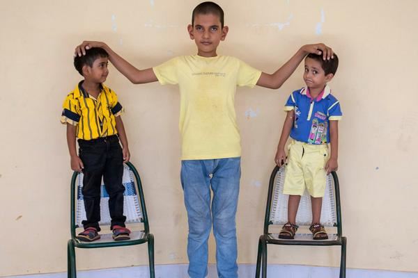 baru 8 tahun tapi kanak-kanak ini dah capai tinggi 1.85 meter !