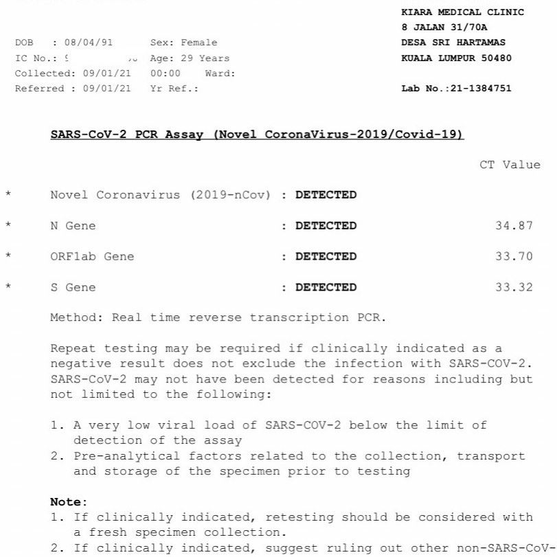 tiada kontak rapat, pelakon shima anuar positif covid-19