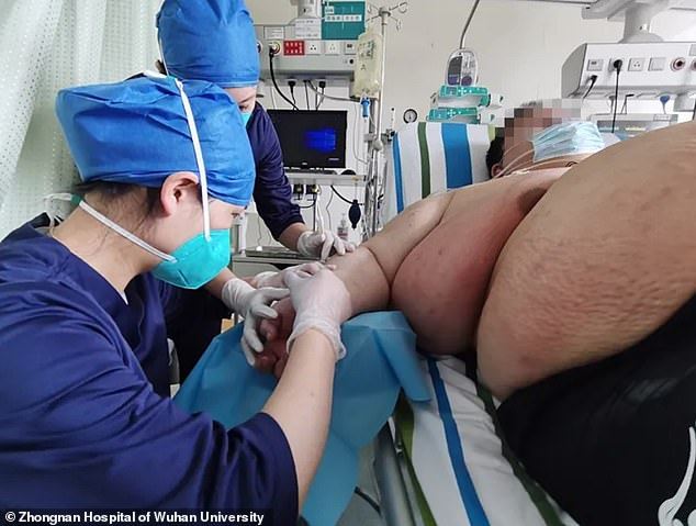 gara-gara lockdown, berat lelaki ini tambah lagi 102 kilogram