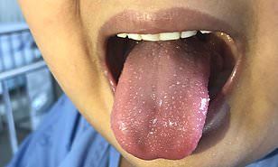 pakar perubatan dakwa penyakit kawasaki mungkin meningkat akibat covid-19