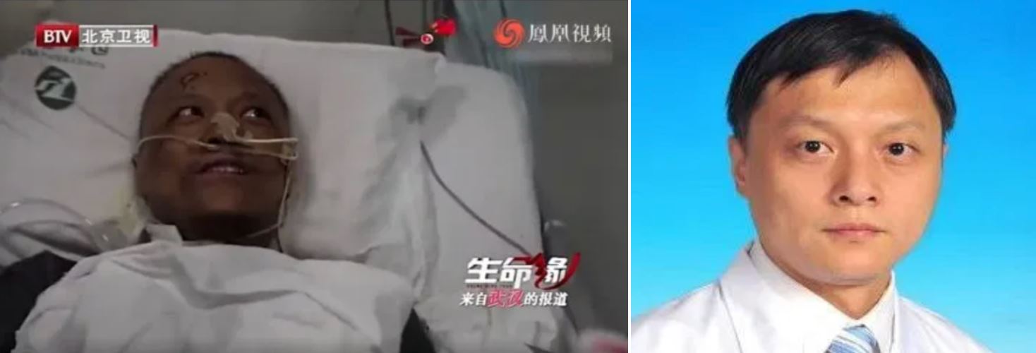 dua doktor china bertukar warna kulit selepas dijangkiti covid-19