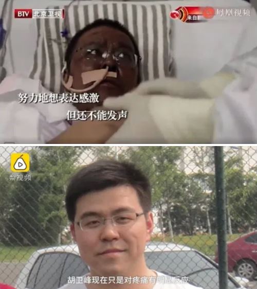 dua doktor china bertukar warna kulit selepas dijangkiti covid-19