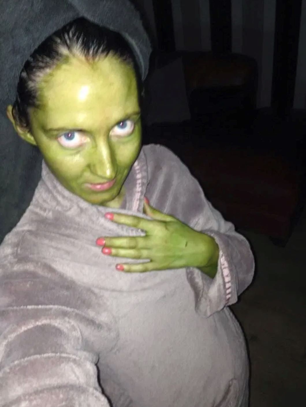 akibat guna krim tiruan, kulit wanita ini bertukar jadi shrek