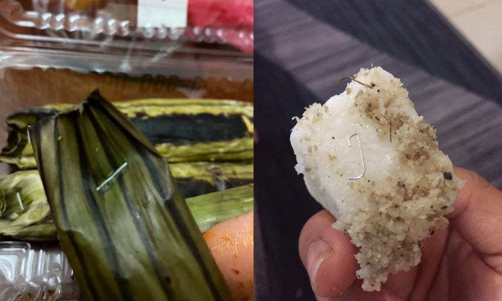 budak bengkak gusi rupanya tergigit dawai stapler dari makanan