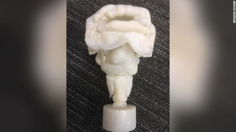 saintis cipta semula suara daripada mumia berusia 3,000 tahun. hasilnya memang menyeramkan