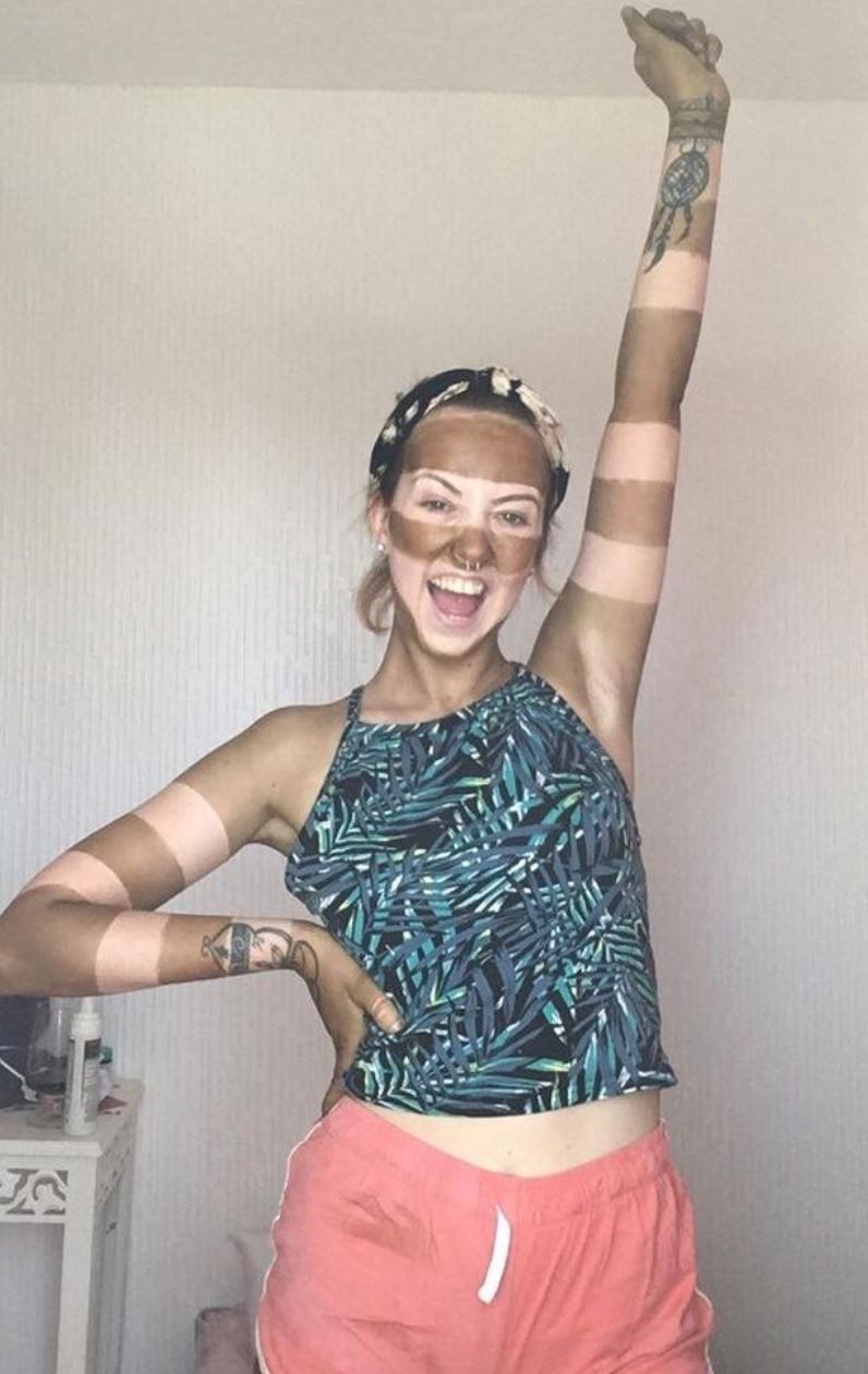 bosan duduk rumah, wanita berjaya hasilkan kulit belang-belang lepas berjemur