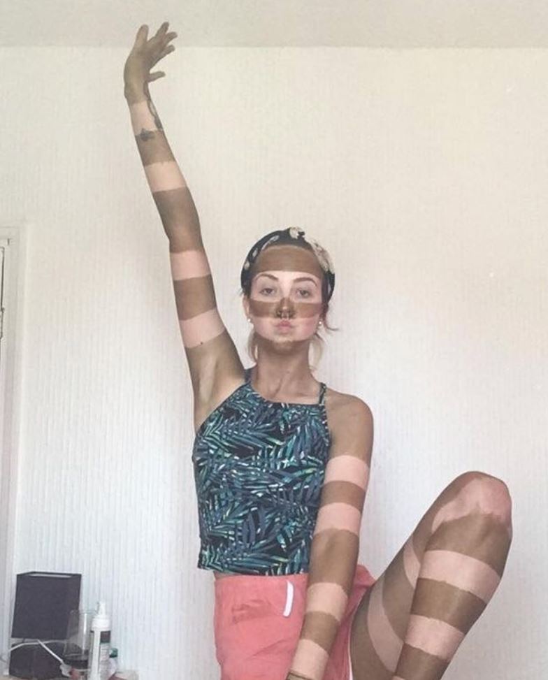 bosan duduk rumah, wanita berjaya hasilkan kulit belang-belang lepas berjemur