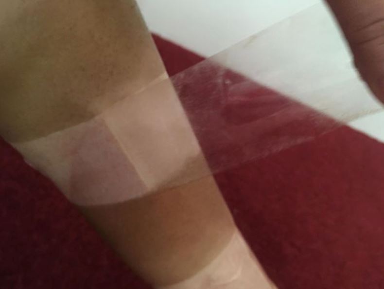 bosan duduk rumah, wanita berjaya hasilkan kulit belang-belang lepas berjemur