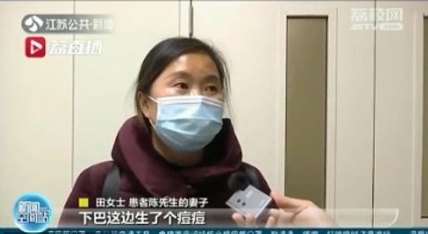 lelaki hampir maut lepas picit jerawat pada dagu, ‘‘mulutnya bengkak dan badan panas..’’