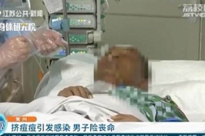 lelaki hampir maut lepas picit jerawat pada dagu, ‘‘mulutnya bengkak dan badan panas..’’