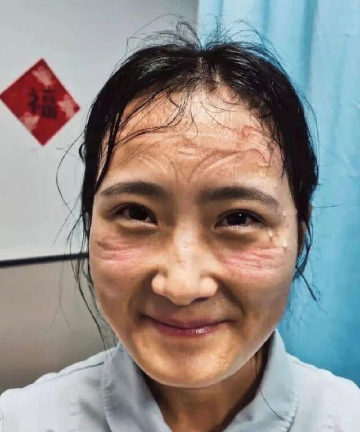 sampai berbekas muka nurse seharian pakai face mask berperang dengan covid-19