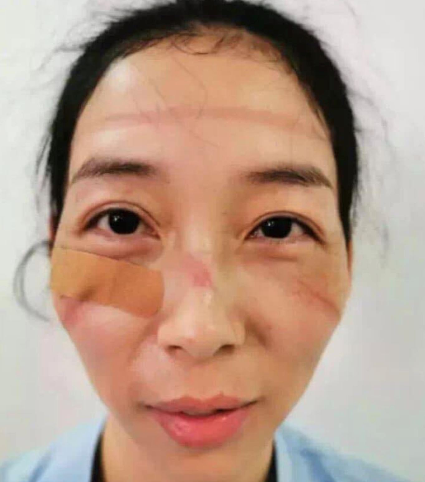 sampai berbekas muka nurse seharian pakai face mask berperang dengan covid-19