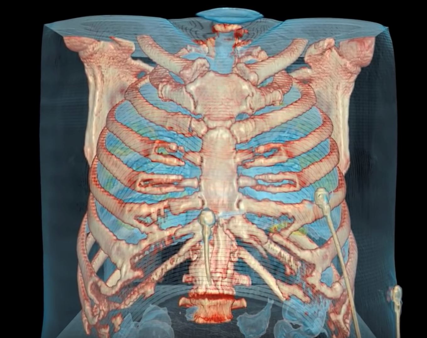 guna teknologi vr, lihat bagaimana virus covid-19 rosakkan paru-paru