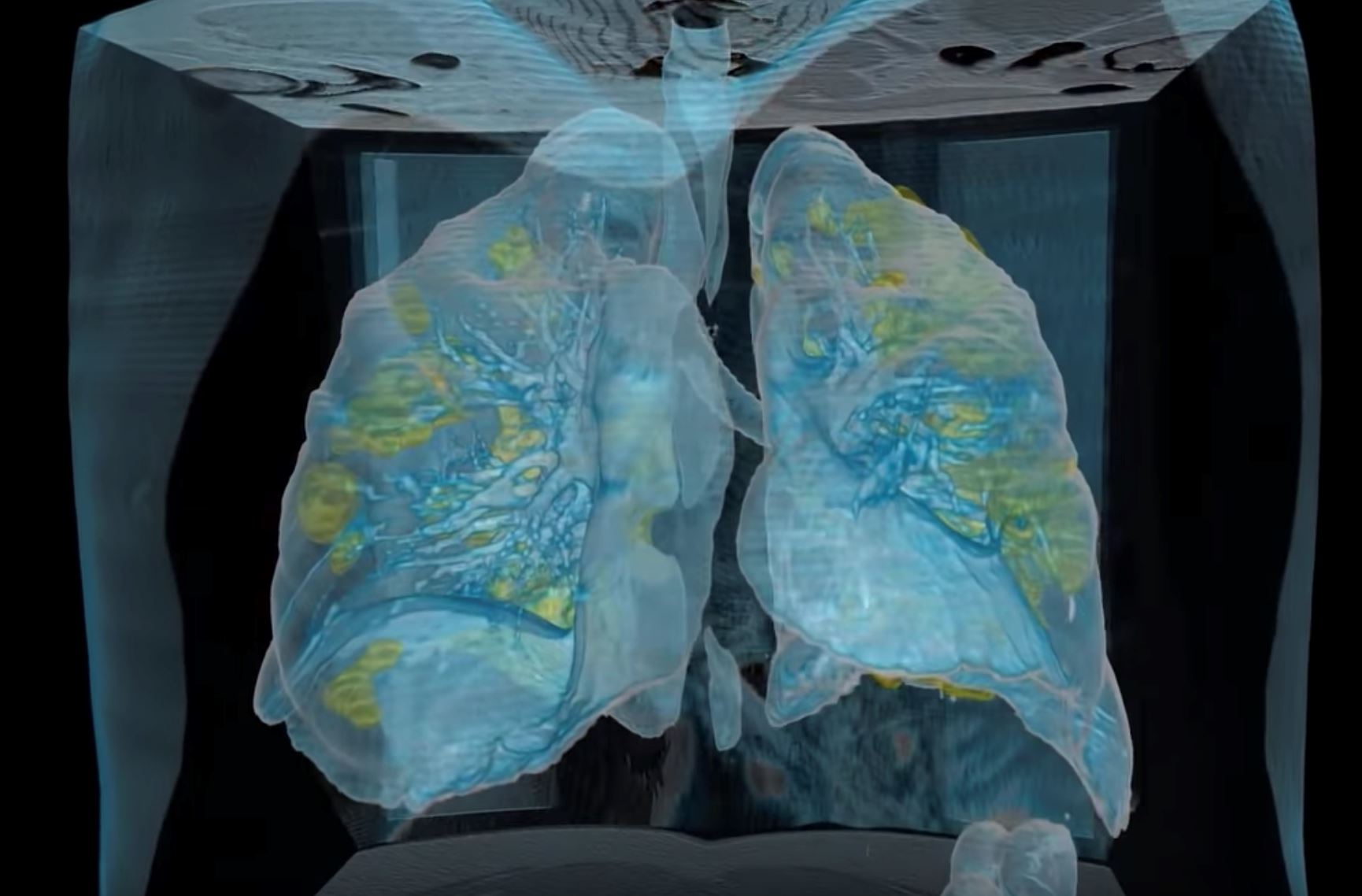 guna teknologi vr, lihat bagaimana virus covid-19 rosakkan paru-paru