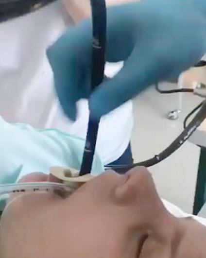 ular 1.2 meter panjang masuk dalam mulut wanita masa tidur