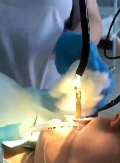 ular 1.2 meter panjang masuk dalam mulut wanita masa tidur