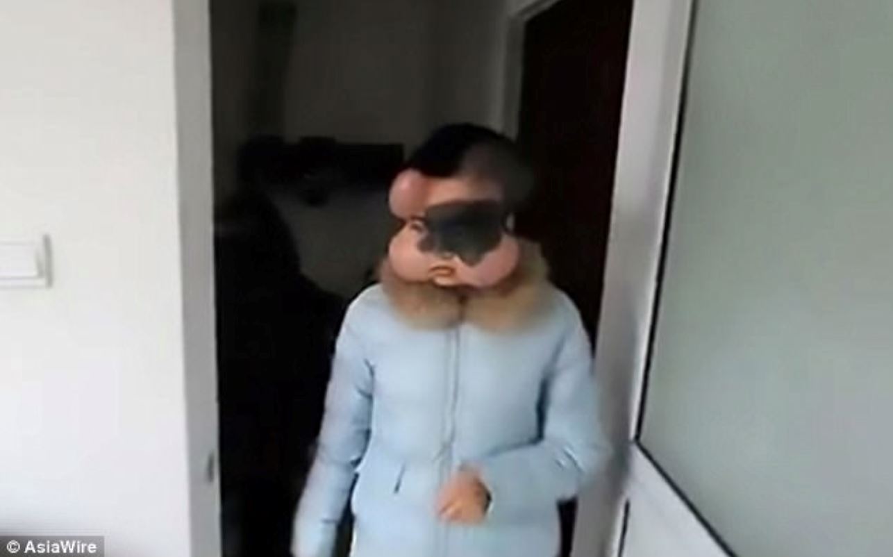 nak buang kanser, doktor kena tanam 4 belon bawah muka gadis ini